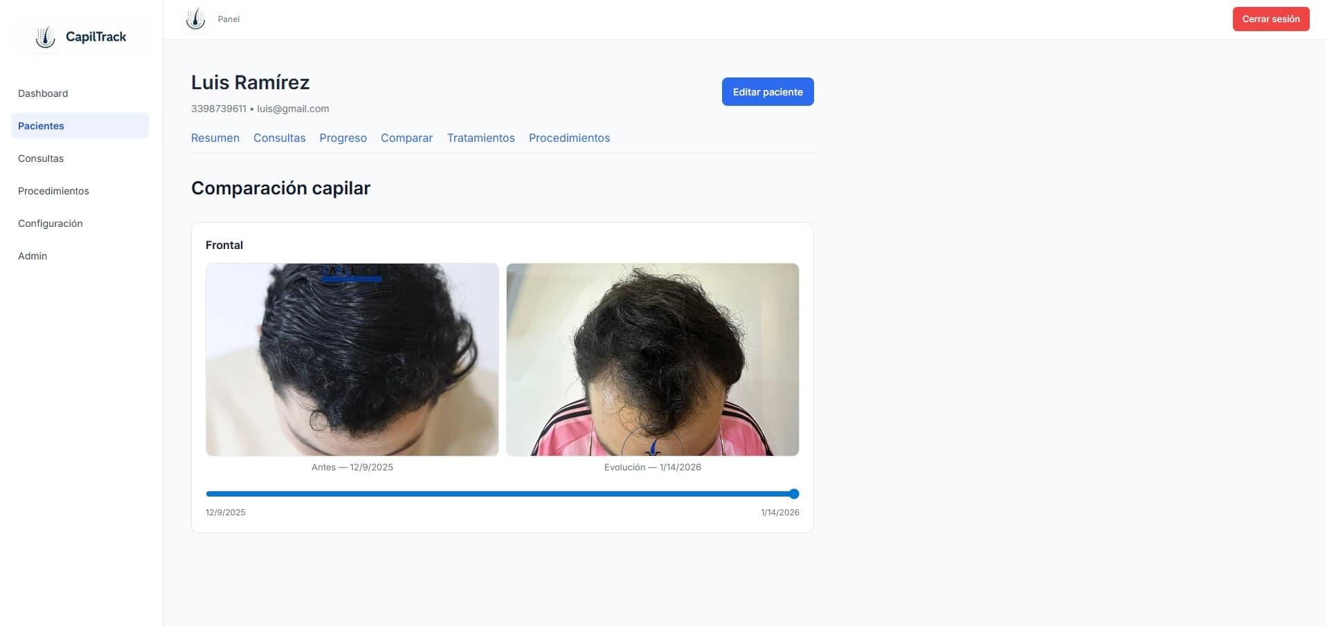 Comparativas antes y después