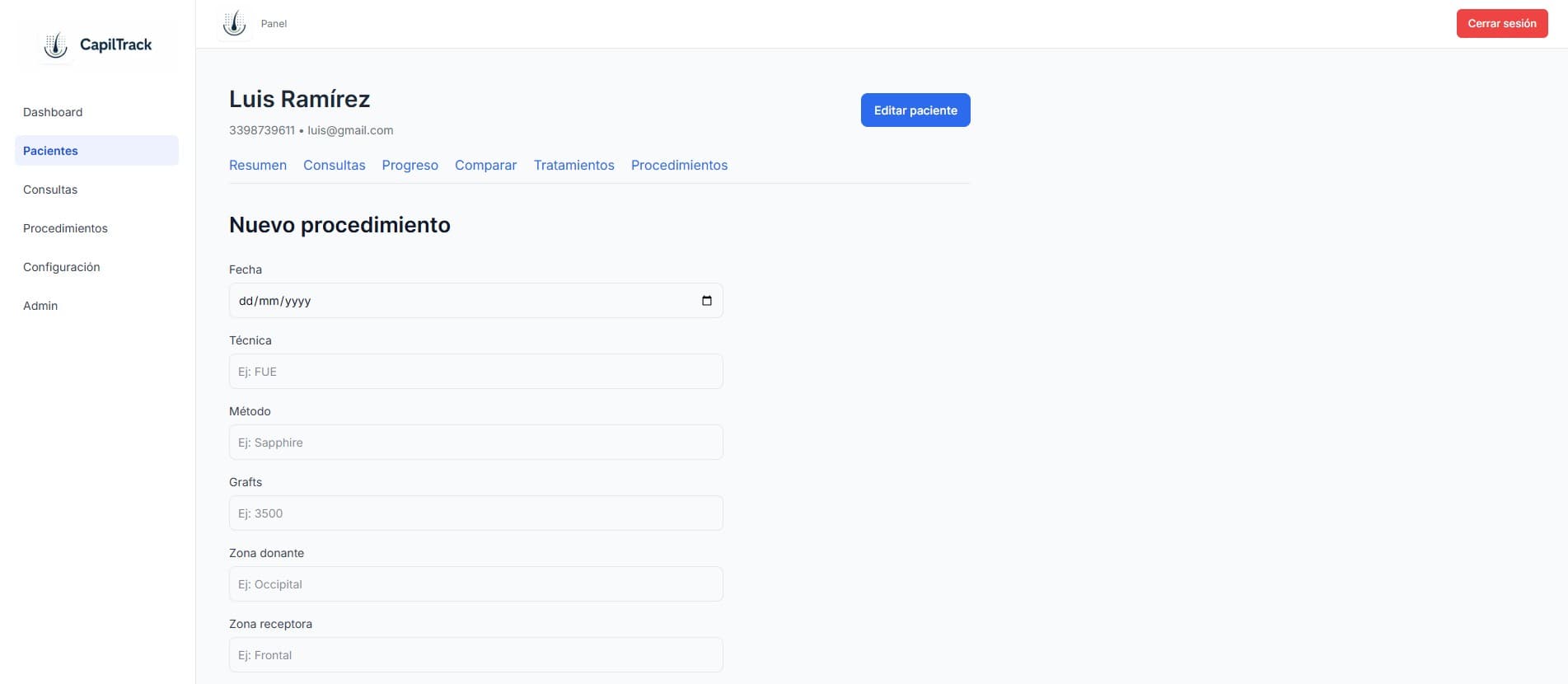 Registro de procedimientos